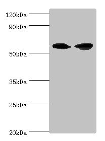 AHCYL1 / DCAL Antibody - Western blot All lanes: AHCYL1 antibody at 12µg/ml Lane 1: Hela whole cell lysate Lane 2: 293T whole cell lysate Secondary Goat polyclonal to rabbit IgG at 1/10000 dilution Predicted band size: 59, 54 kDa Observed band size: 59 kDa