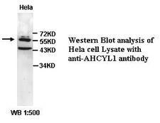 AHCYL1 / DCAL Antibody