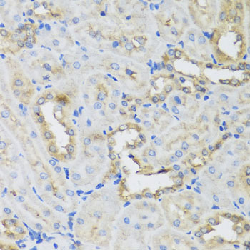 AHCYL1 / DCAL Antibody - Immunohistochemistry of paraffin-embedded rat kidney tissue.