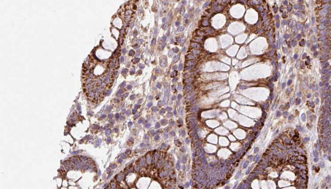 AHCYL1 / DCAL Antibody - 1:100 staining mouse colon tissue by IHC-P. The sample was formaldehyde fixed and a heat mediated antigen retrieval step in citrate buffer was performed. The sample was then blocked and incubated with the antibody for 1.5 hours at 22°C. An HRP conjugated goat anti-rabbit antibody was used as the secondary.