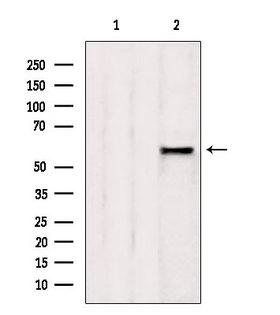 AHCYL1 / DCAL Antibody - Western blot analysis of extracts of rat spleen using AHCYL1 antibody. Lane 1 was treated with the blocking peptide.