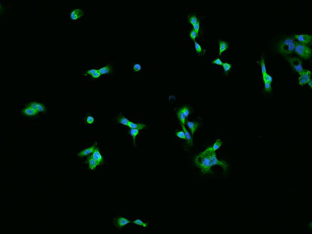 AHCYL1 / DCAL Antibody - Immunofluorescence staining of AHCYL1 in A431 cells. Cells were fixed with 4% PFA, permeabilzed with 0.1% Triton X-100 in PBS, blocked with 10% serum, and incubated with rabbit anti-Human AHCYL1 polyclonal antibody (dilution ratio 1:200) at 4°C overnight. Then cells were stained with the Alexa Fluor 488-conjugated Goat Anti-rabbit IgG secondary antibody (green) and counterstained with DAPI (blue). Positive staining was localized to Cytoplasm.