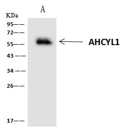 AHCYL1 / DCAL Antibody - AHCYL1 was immunoprecipitated using: Lane A: 0.5 mg 293T Whole Cell Lysate. 4 uL anti-AHCYL1 rabbit polyclonal antibody and 60 ug of Immunomagnetic beads Protein A/G. Primary antibody: Anti-AHCYL1 rabbit polyclonal antibody, at 1:100 dilution. Secondary antibody: Clean-Blot IP Detection Reagent (HRP) at 1:1000 dilution. Developed using the ECL technique. Performed under reducing conditions. Predicted band size: 59 kDa. Observed band size: 59 kDa.