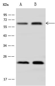 AHCYL1 / DCAL Antibody - Anti-AHCYL1 rabbit polyclonal antibody at 1:500 dilution. Lane A: HeLa Whole Cell Lysate. Lane B: 293T Whole Cell Lysate. Lysates/proteins at 30 ug per lane. Secondary: Goat Anti-Rabbit IgG (H+L)/HRP at 1/10000 dilution. Developed using the ECL technique. Performed under reducing conditions. Predicted band size: 59 kDa. Observed band size: 59 kDa.