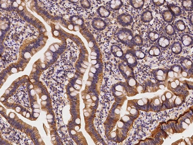 AHCYL1 / DCAL Antibody - Immunochemical staining of human AHCYL1 in human duodenum with rabbit polyclonal antibody at 1:500 dilution, formalin-fixed paraffin embedded sections.