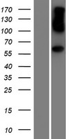 AHCYL1 / DCAL Protein - Western validation with an anti-DDK antibody * L: Control HEK293 lysate R: Over-expression lysate