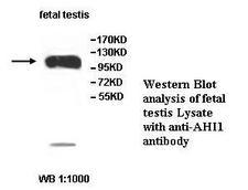 AHI1 Antibody