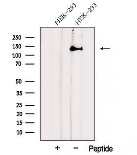 AHI1 Antibody - Western blot analysis of extracts of HEK293 cells using AHI1 antibody. The lane on the left was treated with blocking peptide.