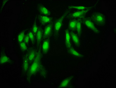 AHNAK Antibody - Immunofluorescence staining of Hela cells at a dilution of 1:166, counter-stained with DAPI. The cells were fixed in 4% formaldehyde, permeabilized using 0.2% Triton X-100 and blocked in 10% normal Goat Serum. The cells were then incubated with the antibody overnight at 4 °C.The secondary antibody was Alexa Fluor 488-congugated AffiniPure Goat Anti-Rabbit IgG (H+L) .