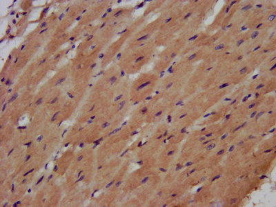 AHNAK Antibody - IHC image of AHNAK Antibody diluted at 1:500 and staining in paraffin-embedded human heart tissue performed on a Leica BondTM system. After dewaxing and hydration, antigen retrieval was mediated by high pressure in a citrate buffer (pH 6.0). Section was blocked with 10% normal goat serum 30min at RT. Then primary antibody (1% BSA) was incubated at 4°C overnight. The primary is detected by a biotinylated secondary antibody and visualized using an HRP conjugated SP system.