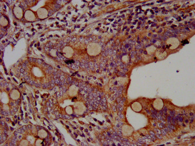 AHNAK Antibody - IHC image of AHNAK Antibody diluted at 1:500 and staining in paraffin-embedded human small intestine tissue performed on a Leica BondTM system. After dewaxing and hydration, antigen retrieval was mediated by high pressure in a citrate buffer (pH 6.0). Section was blocked with 10% normal goat serum 30min at RT. Then primary antibody (1% BSA) was incubated at 4°C overnight. The primary is detected by a biotinylated secondary antibody and visualized using an HRP conjugated SP system.