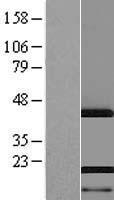 AHNAK Protein - Western validation with an anti-DDK antibody * L: Control HEK293 lysate R: Over-expression lysate