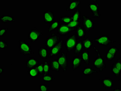 AHNAK2 Antibody - Immunofluorescence staining of A549 cells at a dilution of 1:133, counter-stained with DAPI. The cells were fixed in 4% formaldehyde, permeabilized using 0.2% Triton X-100 and blocked in 10% normal Goat Serum. The cells were then incubated with the antibody overnight at 4 °C.The secondary antibody was Alexa Fluor 488-congugated AffiniPure Goat Anti-Rabbit IgG (H+L) .