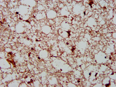 AHNAK2 Antibody - Immunohistochemistry image at a dilution of 1:400 and staining in paraffin-embedded human brain tissue performed on a Leica BondTM system. After dewaxing and hydration, antigen retrieval was mediated by high pressure in a citrate buffer (pH 6.0) . Section was blocked with 10% normal goat serum 30min at RT. Then primary antibody (1% BSA) was incubated at 4 °C overnight. The primary is detected by a biotinylated secondary antibody and visualized using an HRP conjugated SP system.