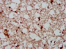 AHNAK2 Antibody - Immunohistochemistry image at a dilution of 1:400 and staining in paraffin-embedded human brain tissue performed on a Leica BondTM system. After dewaxing and hydration, antigen retrieval was mediated by high pressure in a citrate buffer (pH 6.0) . Section was blocked with 10% normal goat serum 30min at RT. Then primary antibody (1% BSA) was incubated at 4 °C overnight. The primary is detected by a biotinylated secondary antibody and visualized using an HRP conjugated SP system.