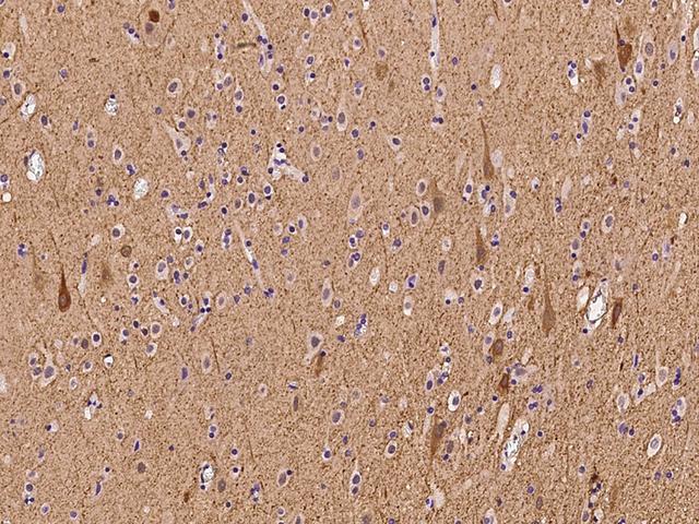 AHNAK2 Antibody - Immunochemical staining of human AHNAK2 in human brain with rabbit polyclonal antibody at 1:100 dilution, formalin-fixed paraffin embedded sections.