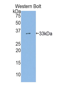 AHR Antibody - Western blot of recombinant AHR.  This image was taken for the unconjugated form of this product. Other forms have not been tested.