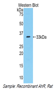 AHR Antibody - Western blot of recombinant AHR.  This image was taken for the unconjugated form of this product. Other forms have not been tested.