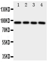 AHR Antibody - Anti-AHR antibody, Western blotting All lanes: Anti AHR at 0.5ug/ml Lane 1: PANC Whole Cell Lysate at 40ug Lane 2: HELA Whole Cell Lysate at 40ug Lane 3: MCF-7 Whole Cell Lysate at 40ug Lane 4: HT1080 Whole Cell Lysate at 40ug Predicted bind size: 96KD Observed bind size: 96KD