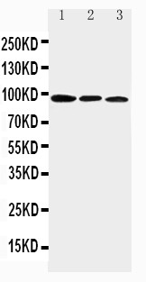 AHR Antibody - Aryl hydrocarbon Receptor antibody Western blot. Lane 1: Mouse Brain Tissue Lysate. Lane 2: Mouse Heart Tissue Lysate. Lane 3: Mouse Liver Tissue Lysate.