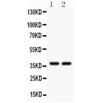 AHR Antibody - AHR antibody Western blot. All lanes: Anti AHR at 0.5 ug/ml. Lane 1: Rat Brain Tissue Lysate at 50 ug. Lane 2: Mouse Liver Tissue Lysate at 50 ug. Predicted band size: 38 kD. Observed band size: 38 kD.