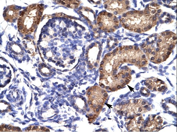 AHR Antibody - AHR antibody ARP32243_T100-NP_001612-AHR (aryl hydrocarbon receptor) Antibody was used in IHC to stain formalin-fixed, paraffin-embedded human kidney.  This image was taken for the unconjugated form of this product. Other forms have not been tested.