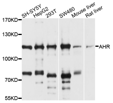 AHR Antibody - Western blot analysis of extracts of various cell lines, using AHR antibody at 1:1000 dilution. The secondary antibody used was an HRP Goat Anti-Rabbit IgG (H+L) at 1:10000 dilution. Lysates were loaded 25ug per lane and 3% nonfat dry milk in TBST was used for blocking. An ECL Kit was used for detection and the exposure time was 5s.