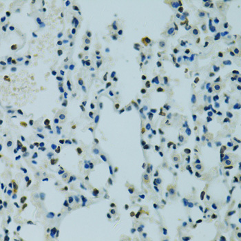 AHR Antibody - Immunohistochemistry of paraffin-embedded mouse lung using AHR antibodyat dilution of 1:100 (40x lens).