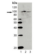 AHR Antibody - Western blot of AhR polyclonal antibody: Lane 1: MW marker; Lane 2: Rat liver lysate; Lane 3: Mouse liver lysate.
