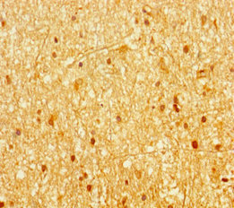 AHR Antibody - Immunohistochemistry of paraffin-embedded human brain tissue at dilution of 1:100