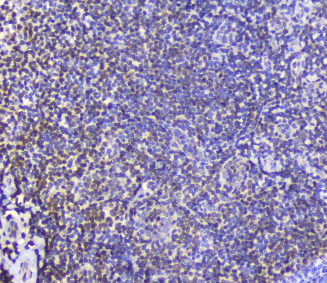 AHR Antibody - IHC analysis of AHR using anti-AHR antibody. AHR was detected in paraffin-embedded section of human tonsil tissue. Heat mediated antigen retrieval was performed in citrate buffer (pH6, epitope retrieval solution) for 20 mins. The tissue section was blocked with 10% goat serum. The tissue section was then incubated with 2µg/ml rabbit anti-AHR Antibody overnight at 4°C. Biotinylated goat anti-rabbit IgG was used as secondary antibody and incubated for 30 minutes at 37°C. The tissue section was developed using Strepavidin-Biotin-Complex (SABC) with DAB as the chromogen.