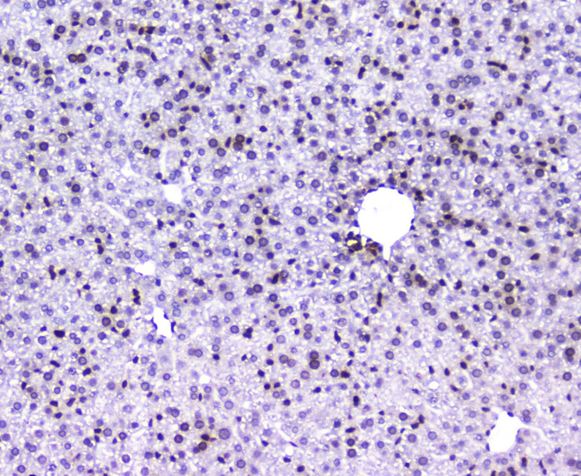 AHR Antibody - IHC analysis of AHR using anti-AHR antibody. AHR was detected in paraffin-embedded section of mouse liver tissue. Heat mediated antigen retrieval was performed in citrate buffer (pH6, epitope retrieval solution) for 20 mins. The tissue section was blocked with 10% goat serum. The tissue section was then incubated with 2µg/ml rabbit anti-AHR Antibody overnight at 4°C. Biotinylated goat anti-rabbit IgG was used as secondary antibody and incubated for 30 minutes at 37°C. The tissue section was developed using Strepavidin-Biotin-Complex (SABC) with DAB as the chromogen.