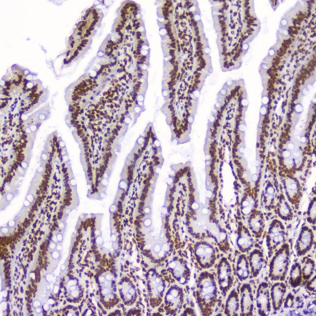 AHR Antibody - IHC analysis of AHR using anti-AHR antibody. AHR was detected in paraffin-embedded section of rat small intestine tissue. Heat mediated antigen retrieval was performed in citrate buffer (pH6, epitope retrieval solution) for 20 mins. The tissue section was blocked with 10% goat serum. The tissue section was then incubated with 2µg/ml rabbit anti-AHR Antibody overnight at 4°C. Biotinylated goat anti-rabbit IgG was used as secondary antibody and incubated for 30 minutes at 37°C. The tissue section was developed using Strepavidin-Biotin-Complex (SABC) with DAB as the chromogen.