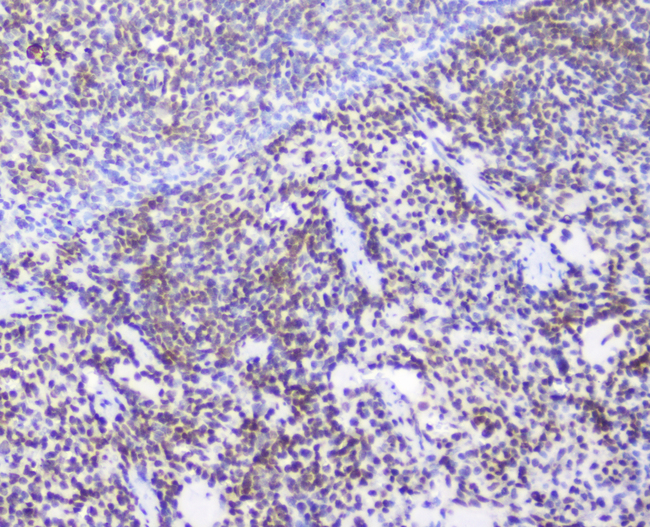AHR Antibody - IHC analysis of AHR using anti-AHR antibody. AHR was detected in paraffin-embedded section of rat spleen tissue. Heat mediated antigen retrieval was performed in citrate buffer (pH6, epitope retrieval solution) for 20 mins. The tissue section was blocked with 10% goat serum. The tissue section was then incubated with 2µg/ml rabbit anti-AHR Antibody overnight at 4°C. Biotinylated goat anti-rabbit IgG was used as secondary antibody and incubated for 30 minutes at 37°C. The tissue section was developed using Strepavidin-Biotin-Complex (SABC) with DAB as the chromogen.