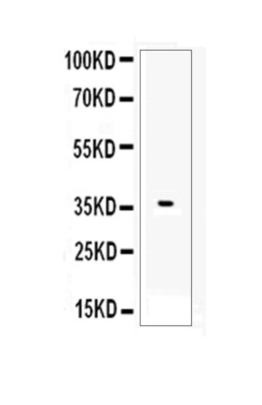 AHR Antibody - Western blot analysis of AHR using anti-AHR antibody. Electrophoresis was performed on a 5-20% SDS-PAGE gel at 70V (Stacking gel) / 90V (Resolving gel) for 2-3 hours. Lane 1: recombinant human AHR protein 1ng. After Electrophoresis, proteins were transferred to a Nitrocellulose membrane at 150mA for 50-90 minutes. Blocked the membrane with 5% Non-fat Milk/ TBS for 1.5 hour at RT. The membrane was incubated with rabbit anti-AHR antigen affinity purified polyclonal antibody at 0.5 µg/mL overnight at 4°C, then washed with TBS-0.1% Tween 3 times with 5 minutes each and probed with a goat anti-rabbit IgG-HRP secondary antibody at a dilution of 1:10000 for 1.5 hour at RT. The signal is developed using an Enhanced Chemiluminescent detection (ECL) kit with Tanon 5200 system. A specific band was detected for AHR at approximately 36KD. The expected band size for AHR is at 36KD.