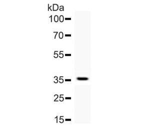 AHR Antibody - Western blot testing of human recombinant partial protein with AHR antibody.