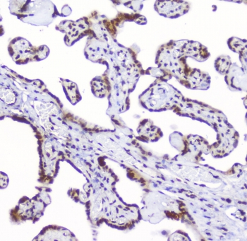 AHR Antibody - IHC staining of FFPE human placenta with AHR antibody at 1ug/ml. HIER: boil tissue sections in pH6, 10mM citrate buffer, for 10-20 min followed by cooling at RT for 20 min.