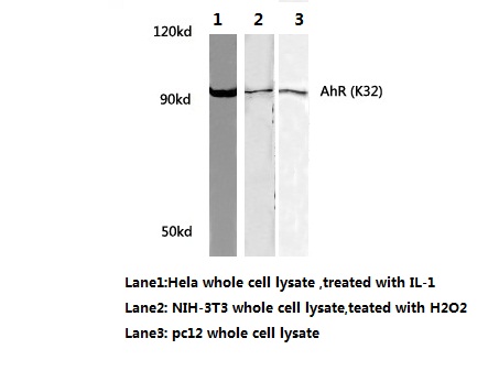 AHR Antibody - Western blot of AhR (K32) pAb in extracts from HeLa(treated with IL-1) cells ,NIH-3T3 (treated with H2O2)cells and pc12 cells.