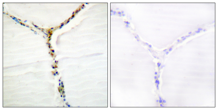 AHR Antibody - Immunohistochemistry analysis of paraffin-embedded human thyroid gland, using AhR (Phospho-Ser36) Antibody. The picture on the right is blocked with the phospho peptide.