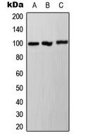 AHR Antibody - Western blot analysis of Ah Receptor (pS36) expression in A431 (A); HepG2 (B); NIH3T3 (C) whole cell lysates.