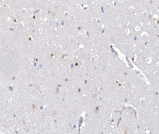 AHR Antibody - 1:100 staining human brain tissue by IHC-P. The tissue was formaldehyde fixed and a heat mediated antigen retrieval step in citrate buffer was performed. The tissue was then blocked and incubated with the antibody for 1.5 hours at 22°C. An HRP conjugated goat anti-rabbit antibody was used as the secondary.
