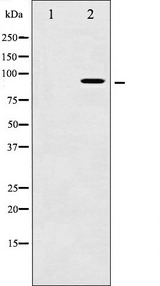 AHR Antibody - Western blot analysis of AhR phosphorylation expression in HepG2 whole cells lysates. The lane on the left is treated with the antigen-specific peptide.