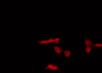 AHR Antibody - Staining HepG2 cells by IF/ICC. The samples were fixed with PFA and permeabilized in 0.1% Triton X-100, then blocked in 10% serum for 45 min at 25°C. The primary antibody was diluted at 1:200 and incubated with the sample for 1 hour at 37°C. An Alexa Fluor 594 conjugated goat anti-rabbit IgG (H+L) Ab, diluted at 1/600, was used as the secondary antibody.