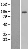 AHR Protein - Western validation with an anti-DDK antibody * L: Control HEK293 lysate R: Over-expression lysate