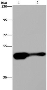 AHRR / AhR Repressor Antibody - Western blot analysis of Mouse liver tissue and HepG2 cell, using AHRR Polyclonal Antibody at dilution of 1:430.