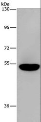 AHRR / AhR Repressor Antibody - Western blot analysis of Mouse brain tissue, using AHRR Polyclonal Antibody at dilution of 1:860.