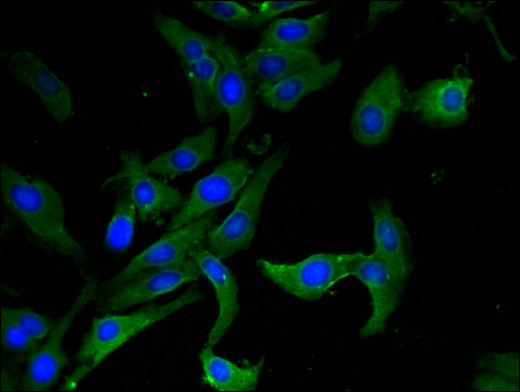 AHRR / AhR Repressor Antibody - Immunofluorescent analysis of Hela cells using AHRR Antibody at a dilution of 1:100 and Alexa Fluor 488-congugated AffiniPure Goat Anti-Rabbit IgG(H+L)