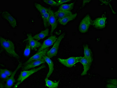 AHRR / AhR Repressor Antibody - Immunofluorescent analysis of Hela cells using AHRR Antibody at dilution of 1:100 and Alexa Fluor 488-congugated AffiniPure Goat Anti-Rabbit IgG(H+L)