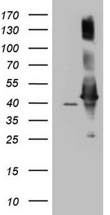 AHSA1 / AHA1 Antibody - HEK293T cells were transfected with the pCMV6-ENTRY control. (Left lane) or pCMV6-ENTRY AHSA1. (Right lane) cDNA for 48 hrs and lysed. Equivalent amounts of cell lysates. (5 ug per lane) were separated by SDS-PAGE and immunoblotted with anti-AHSA1. (1:2000)