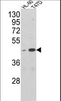 AHSA1 / AHA1 Antibody - Western blot of AHSA1 Antibody in HL-60, T47D cell line lysates (35 ug/lane). AHSA1 (arrow) was detected using the purified antibody.